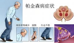<b>帕金森病患者为什么体重下降?奥博帕金森治疗仪有效率</b>